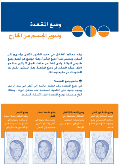 Uitwendige versie en stuitligging Arabisch